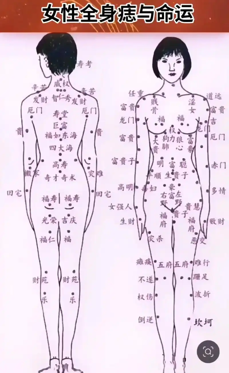 五官痣相图#痣的含义 #成都 #痣的魅力发散时间 #痣 #关 - 抖音