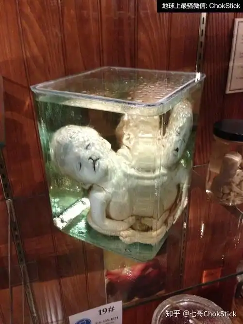 上千个人体标本浸泡在旋转的福尔马林罐子中,其中一些,比如一个长满