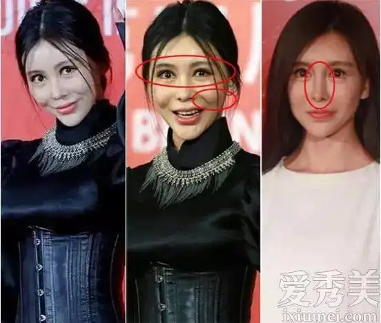 盘点整容失败的女明星后遗症难抵挡
