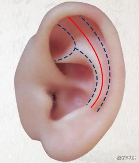 浅述耳廓基本标志线