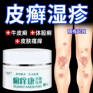 00353人付款淘宝牛皮癣银屑癣藓皮肤瘙痒外用药手足藓体股藓真菌感染