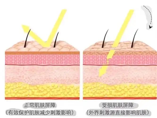 男生毛孔粗大必看男士收缩毛孔用什么最好最有效医学生