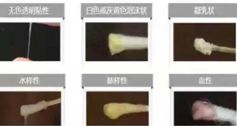 教你通过白带就可以分辨出来子宫卵巢的健康情况!