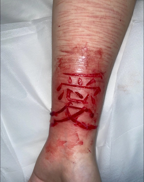 手臂肉雕文字欣赏8