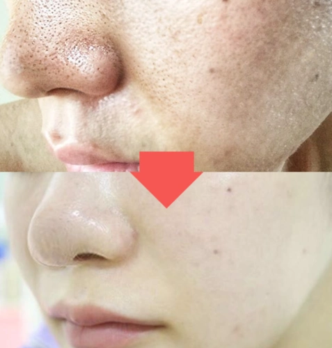 懒人必看【30秒毛孔清洁法】!