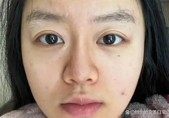 热老化是怎么回事,如何避免热老化,已老化的肌肤如何拯救