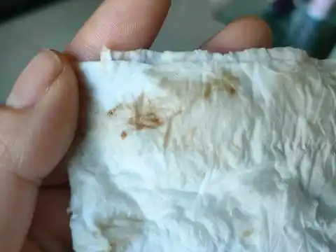 怀孕40多天,今天流出褐色分泌物,上医院检查是宫内早孕,肚子还不痛.