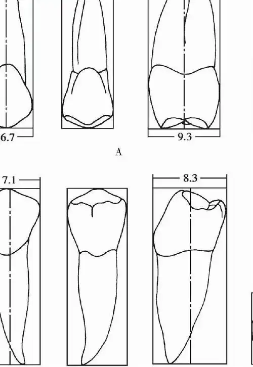 图3-8 上颌第二前磨牙的牙体形态图3-9 上颌第一前磨牙显著的根面凹陷