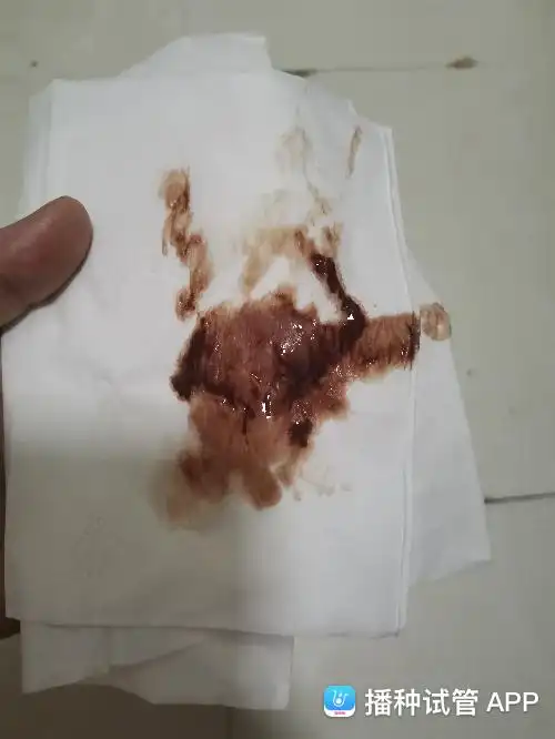 不知道是不是宫腔积血排出来了