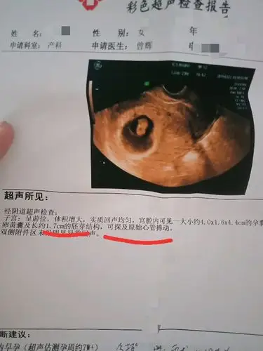 接健康胎芽胎心