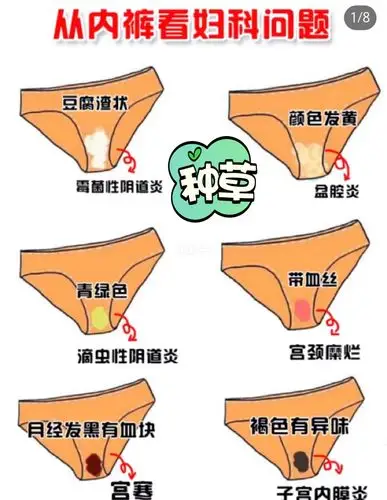 无色无味_妇科_妇科病_子宫_阴道炎_妇科炎症