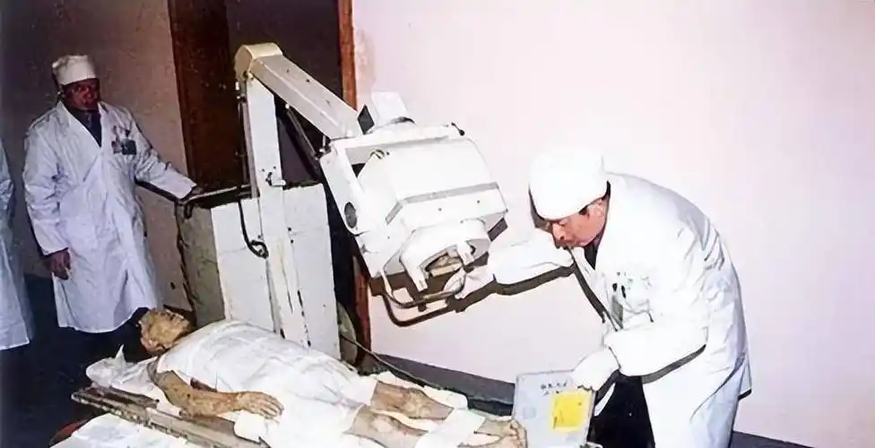 检查女尸解剖第一刀开在了胸部,打开胸腔后,在场人员惊喜地发现,尸体