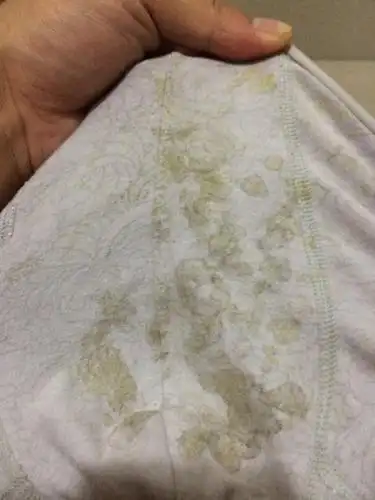 对着光线看了看,发现玲玲的下面都已经开始红肿,小内裤上还有白色的