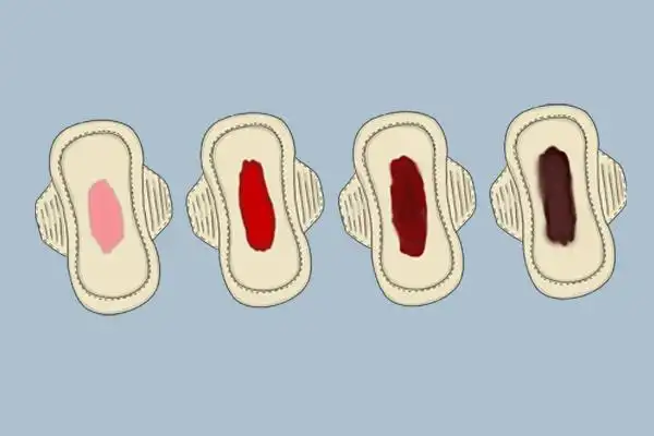 月经结束后为什么还有褐色分泌物是生病了吗告诉你答案