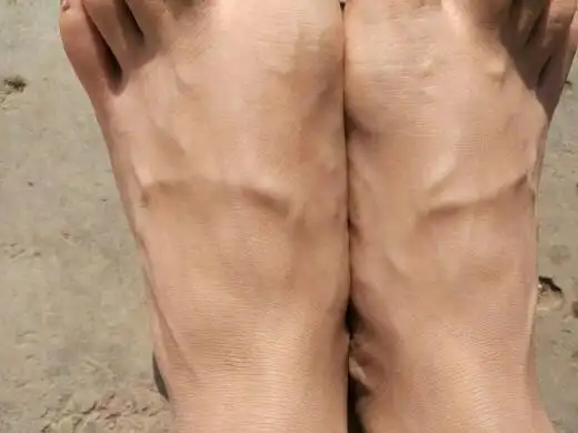 脚的筋为什么涨着,好难受_百度知道