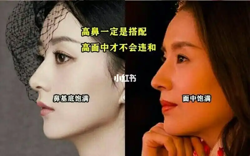 高鼻梁一定适用所有人吗