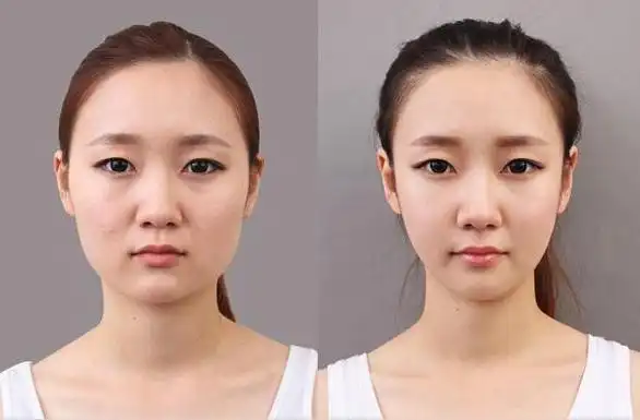 但是某个人的脸型大部分都是以方圆脸为主,那么如何获得小脸蛋呢.