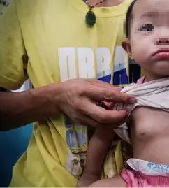 花开过早,女童性早熟防患于未然_性早熟_发病原因_症状表现_如何预防