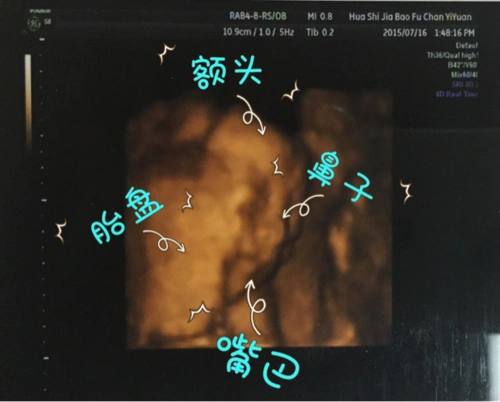 四维归来,高鼻梁大额头健康宝宝一枚