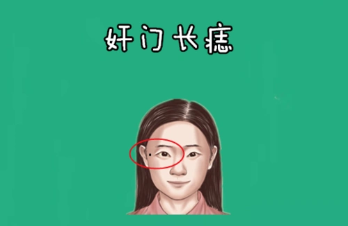 身体5颗"破财"痣,大钱净小钱光,打一辈子工,白辛苦一场!