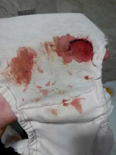 5,6.11终于见红了,有图慎点