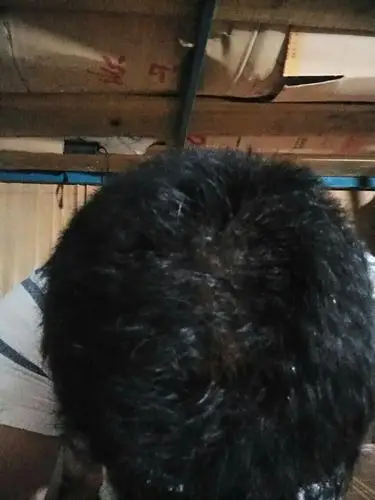 这样头发正常吗?从正面照镜子看可以看到发根和头皮