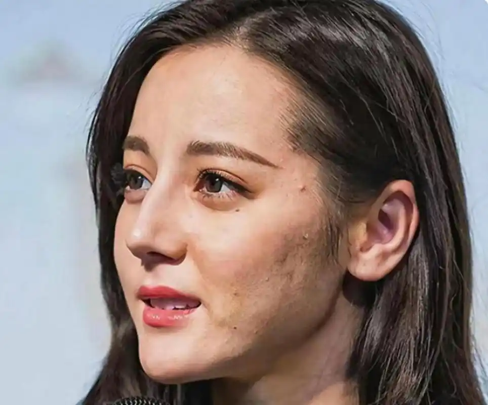 原来迪丽热巴没有美颜,皮肤也好不到哪去啊