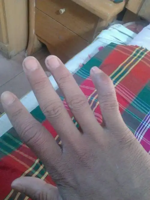 看下我手指头怎么了