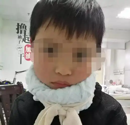 孩子来看病时,脖子已经歪向一边,不能自由活动了.