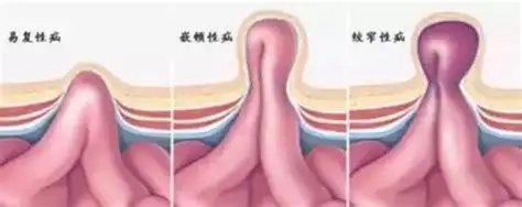 小孩子阴囊肿一边肿大