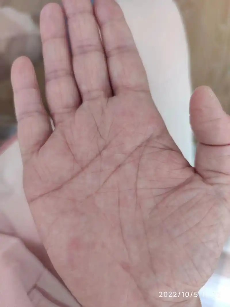 生命线三条分叉,又断开,找遍全网也没解读 有没有懂得帮忙看看,三条