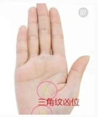手掌上出现几条线构成三角形,称为三角纹,三角纹压在生命线上,表示其