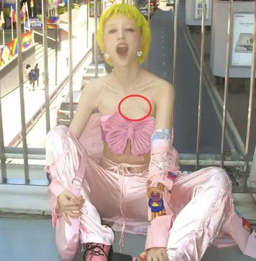 华晨宇女友放飞自我穿着暴露胸口伤痕明显染黄发太个性