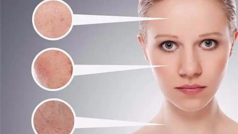 乔颜思:拒绝敏感脸,干性肌肤要如何减少对于肌肤的刺激?