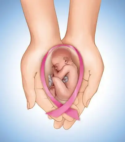 生了69个女人的生育极限在哪里