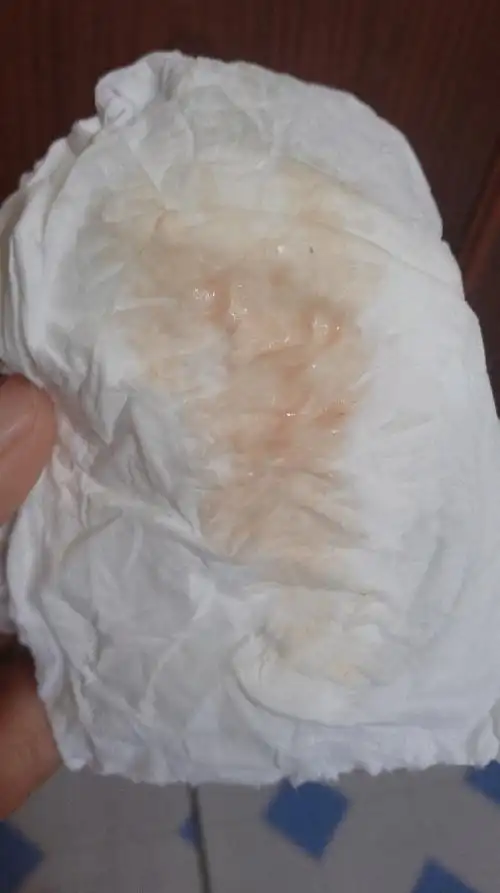 孕6周流褐色血今早起床感觉一股暖流流出,跟月经初期_妈妈网孕育社区