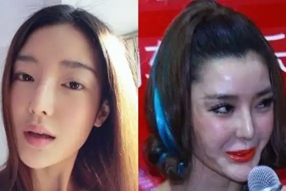 整容失败的4位明星第二位越整越丑你还认识谁