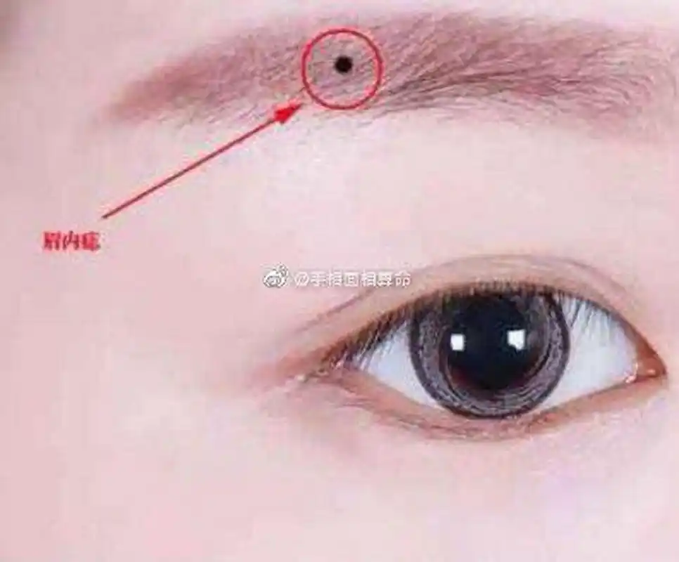 有以下痣相的人一夜暴富不是梦  1:长在眉毛中的痣 眉毛中的痣是位于