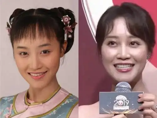 昨天蓝盈莹出席电视剧《精英律师》的定档宣传活动,以_圈子-新氧美容