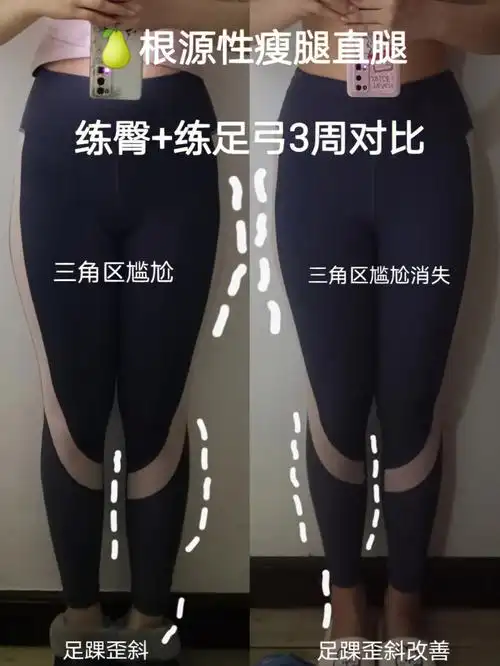 假胯宽收进去了一些,然后惊喜的是三角区尴尬也消失了!意外之喜!3.