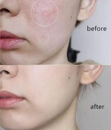 先给大家看几张使用前后对比图