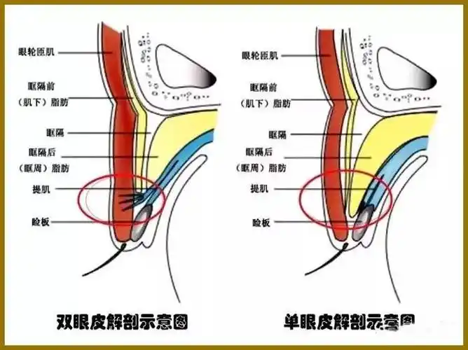 眼睑的组织结构与重睑术