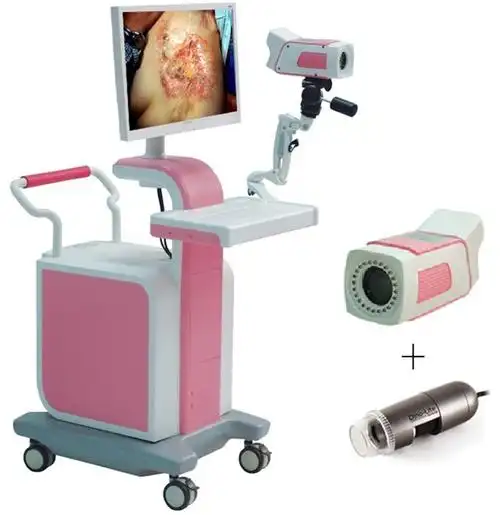 电子皮肤镜(皮肤病诊断)