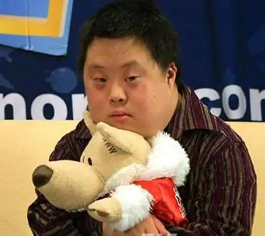 常有这三个现象,准妈妈要注意|怀孕期间|婴儿|高龄产妇|唐氏综合症