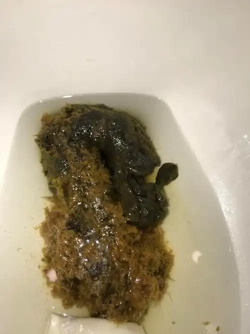 请问这算便血吗?