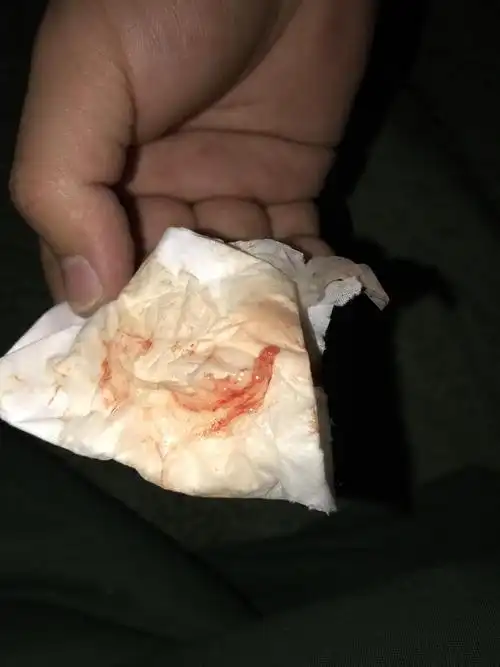 排卵期出血,实在不懂了,有姐妹懂的么?