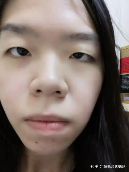 没有鼻梁鼻子塌的人是什么体验