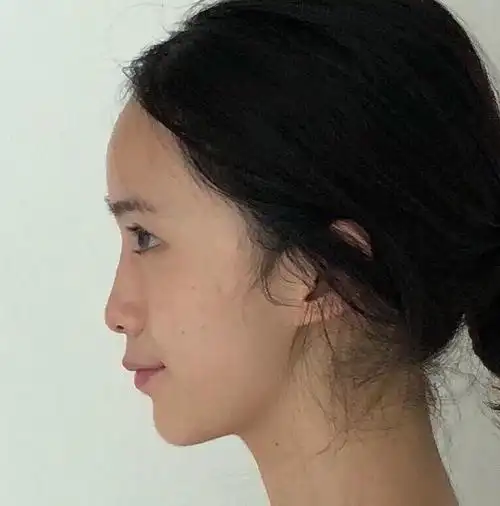 塌鼻梁侧面图片侧脸照片侧脸图塌鼻梁侧脸图亚洲人侧脸扁平日本人侧脸