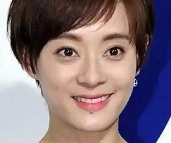 孙俪下巴的痣怎么回事 为什么名人的痣都不愿意去