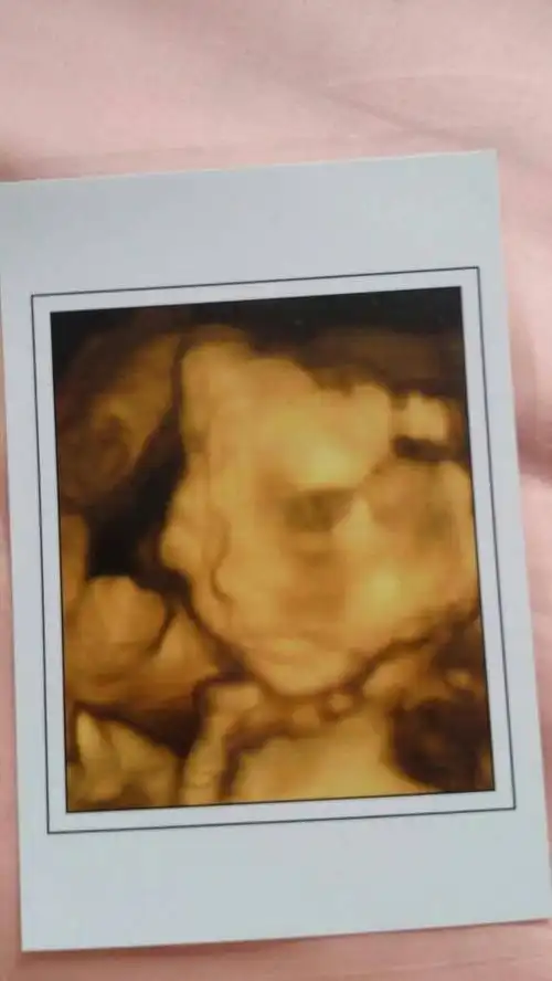 各位妈妈们帮我看看四维照片,我家宝宝是睁着眼吗,那个黑色的是眼睛吧